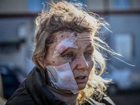 Helena, a 53-year-old teacher, was among the first casualties of Russia's invasion of Ukraine, injured in the bombing of Chuguiv on February 24 last year (Picture: Aris Messinis/AFP via Getty Images)