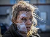 Helena, a 53-year-old teacher, was among the first casualties of Russia's invasion of Ukraine, injured in the bombing of Chuguiv on February 24 last year (Picture: Aris Messinis/AFP via Getty Images)