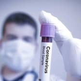 Researchers are urging more people to sign up