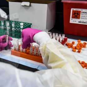 A lab technician sorts blood samples for a Covid-19 vaccine study at the Research Centres of America in Hollywood, Florida. Picture: Chandan Khanna/AFP via Getty Images