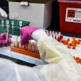 A lab technician sorts blood samples for a Covid-19 vaccine study at the Research Centres of America in Hollywood, Florida. Picture: Chandan Khanna/AFP via Getty Images