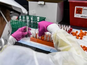 A lab technician sorts blood samples for a Covid-19 vaccine study at the Research Centres of America in Hollywood, Florida. Picture: Chandan Khanna/AFP via Getty Images
