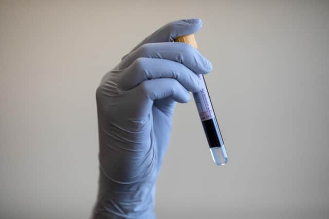 A paramedic holding a test tube containing a blood sample picture: Simon Dawson