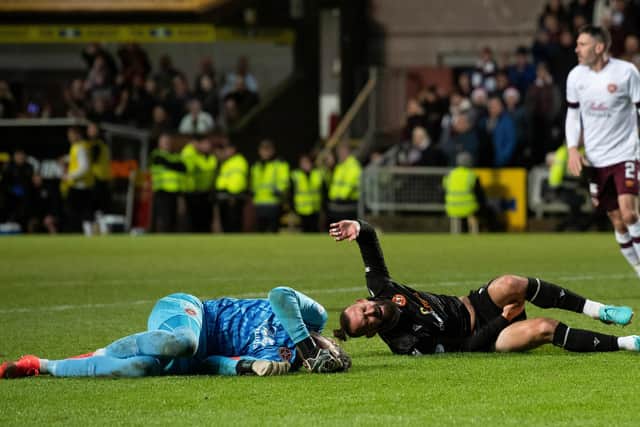 Hearts goalkeeper Craig Gordon picked up a serious leg injury against Dundee United.