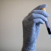 A nurse holds a test tube containing a blood sample. Picture: Simon Dawson/PA Wire