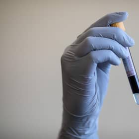 A nurse holds a test tube containing a blood sample. Picture: Simon Dawson/PA Wire