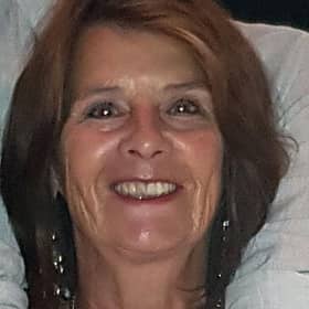 Linda Davis, 71, was in Southwell Road East, Rainworth, when she was hit by a privately-owned electric scooter.