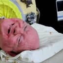 Paul Alexander lived most of his life in an iron lung after contracting polio, but trained as a lawyer and painted pictures (Picture: GoFundMe)
