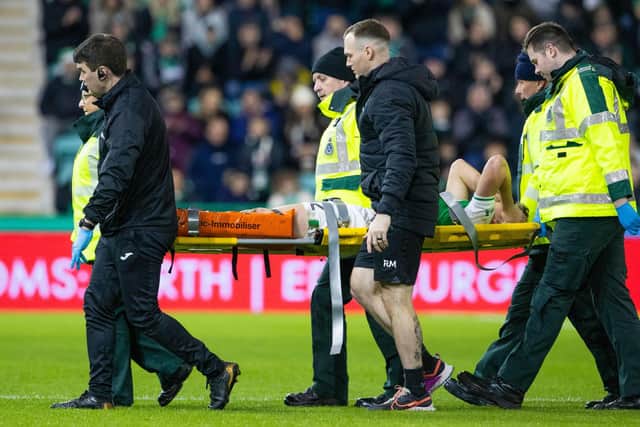 Hibs' Josh Campbell is stretchered off injured during the derby against Hearts.