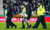 Hibs' Josh Campbell is stretchered off injured during the derby against Hearts.