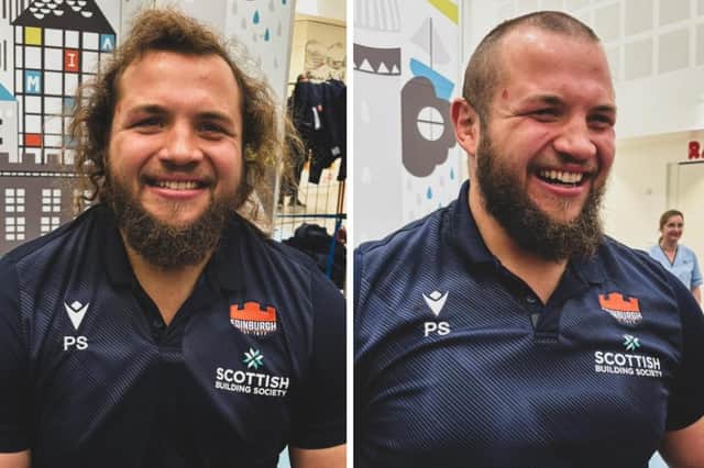 Hair today, gone tomorrow: Pierre Schoeman had his head shaved to raise funds for Edinburgh Children's Hospital Charity.