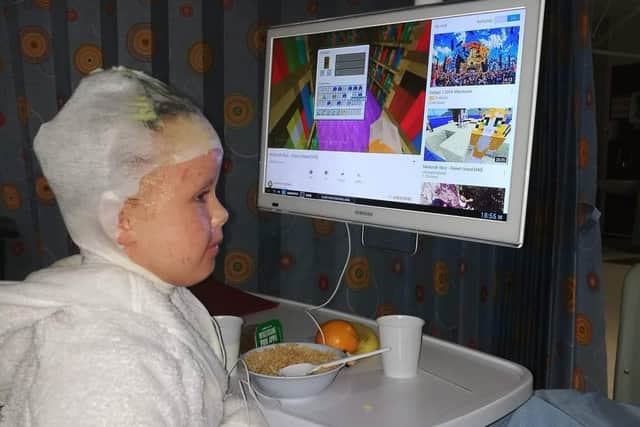 Olivia in hospital for infected eczema.