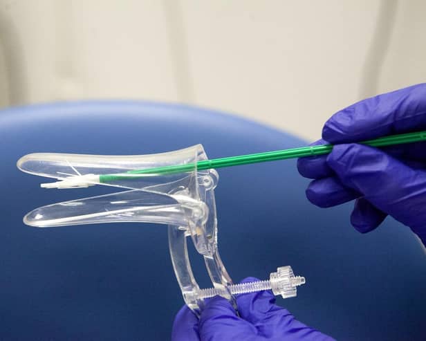 The speculum and soft brush they use for the smear test