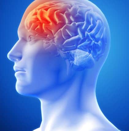 Roughly one in every 100 Scots has epilepsy. Picture: Epilepsy Scotland
