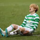 Celtic manager will not say whether or not  Kyogo Furuhashi will require an operation on the hamstring problem that has sidelined him since Boxing Day. (Photo by Craig Williamson / SNS Group)