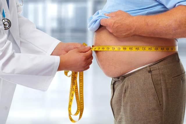 Obesity is a growing problem for national health care