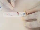 Omega Diagnostics' Visitect CD4 product enables people with HIV to test their immune systems.