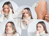 An estimated two million people in the UK are suffering from Long Covid. Picture: NationalWorld