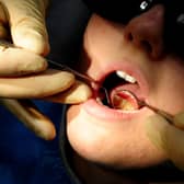 Dentists say the current NHS dentistry system is 'broken' and fundamental reform is required (Picture: Rui Vieira/PA)