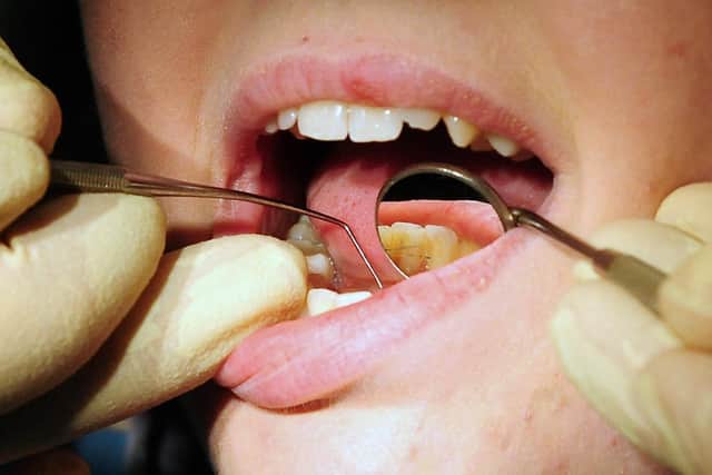 Research by the British Dental Association shows that 59% of dentists questioned had reduced the amount of work they carry out on the NHS. Pic: Rui Vieira/PA Wire