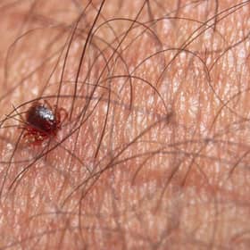 Ticks can sometimes be very small and hard to spot