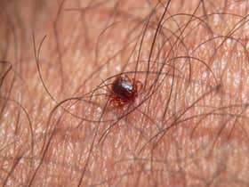 Ticks can sometimes be very small and hard to spot
