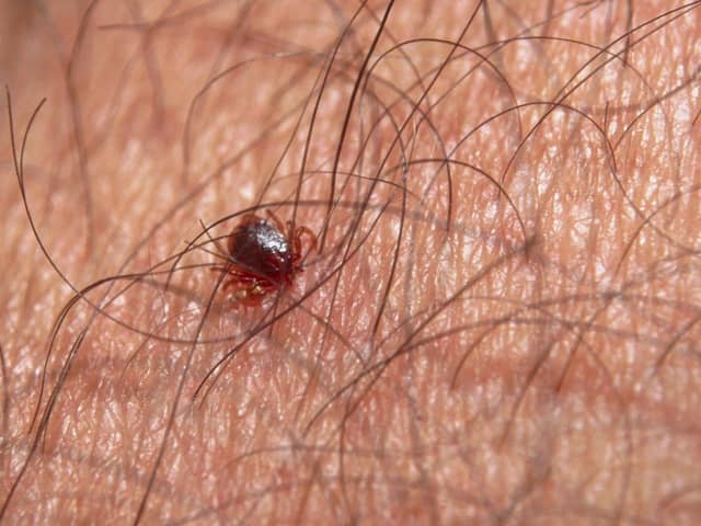 Ticks can sometimes be very small and hard to spot