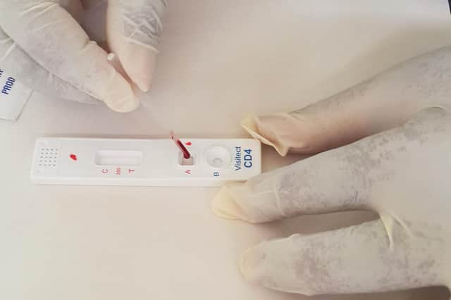 Omega Diagnostics' flagship Visitect CD4 product enables people with HIV to test their immune systems. Picture: contributed.