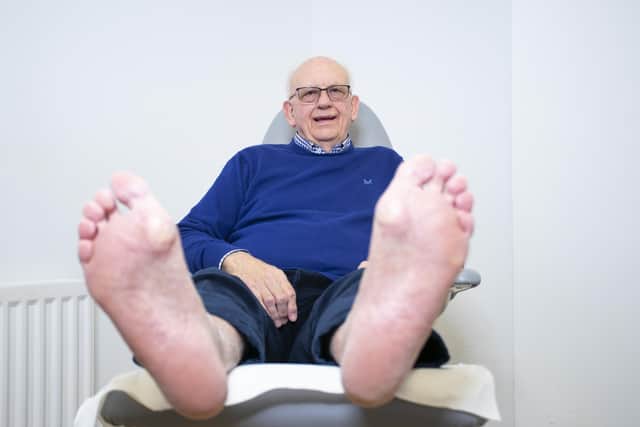 Barry Mayled, whose diabetic ulcerations were treated with Emblation’s Swift device. Photo: Mark Hawkins.