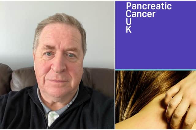 Robert Slaven, from Glasgow, survived pancreatic cancer.