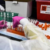 A lab technician sorts blood samples inside a lab for a Covid-19 vaccine study. Picture: Chandan Khanna/AFP via Getty Images