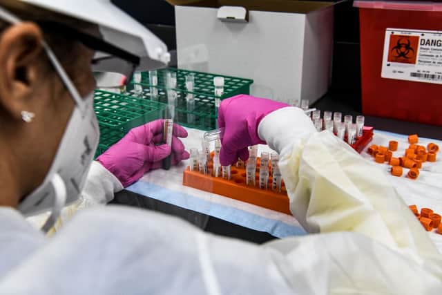 A lab technician sorts blood samples inside a lab for a Covid-19 vaccine study. Picture: Chandan Khanna/AFP via Getty Images