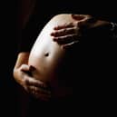 The number of cases of severe complications doubled between 2012 and 2018