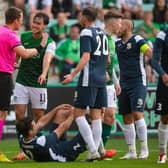 Hibs overcame Santa Coloma two years ago - but Joe Newell was sent off amid theatrics from the Andorrans.