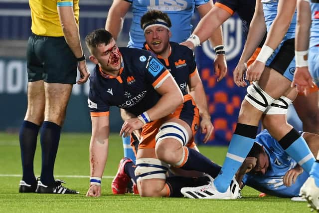 On-form Magnus Bradbury suffers a facial injury during Edinburgh's United Rugby Championship win over Cardiff. (Photo by Paul Devlin / SNS Group)