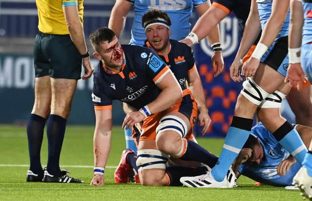 On-form Magnus Bradbury suffers a facial injury during Edinburgh's United Rugby Championship win over Cardiff. (Photo by Paul Devlin / SNS Group)