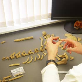Dr Richard Mikulski, a bone specialist from Cornwall Archaeological Unit (CAU) analysing the skeletons. (Pic: Cornwall Council SWNS)