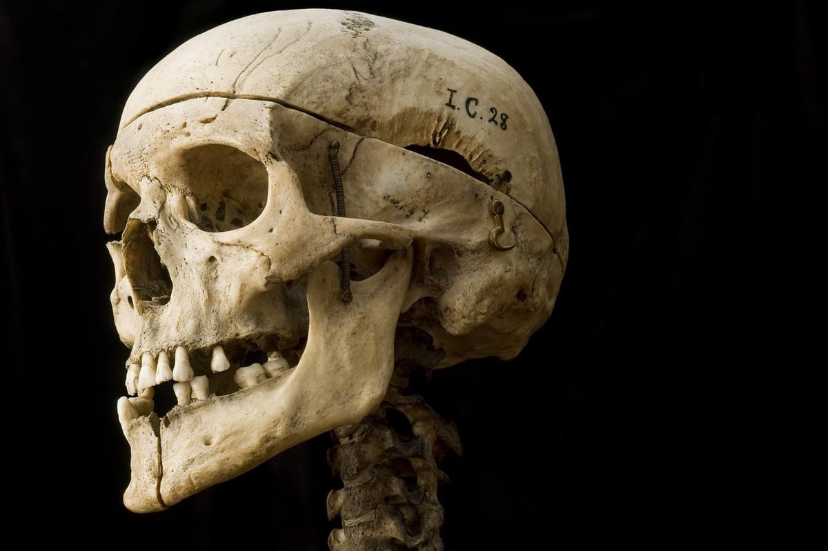 Biggest ever exhibition examining crimes of Burke and Hare set to open in Edinburgh