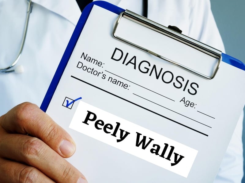 'Peely wally' refers to being pale or sickly looking. If you have a Scottish parent then you probably heard "you're looking a wee bit peely wally" when you were growing up.