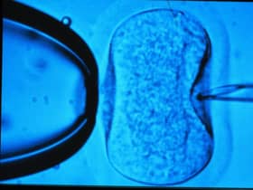 Unvaccinated women can now receive IVF and other fertility treatments.