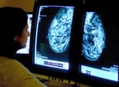 A consultant analysing a mammogram. Picture: Rui Vieira/PA Wire