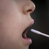 The proportion of people testing positive for Covid-19 in Scotland continued to fall last week, according to the latest figures.