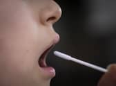 The proportion of people testing positive for Covid-19 in Scotland continued to fall last week, according to the latest figures.