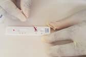 Alva-based Omega Diagnostics has pointed to substantial growth opportunities in the areas of food intolerance, CD4 testing for the management of people living with HIV, and Covid-19 antibody and antigen testing.