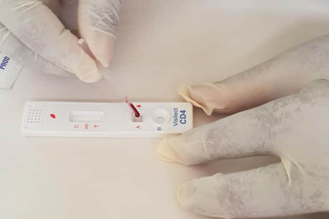 Alva-based Omega Diagnostics has pointed to substantial growth opportunities in the areas of food intolerance, CD4 testing for the management of people living with HIV, and Covid-19 antibody and antigen testing.