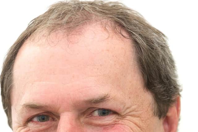 Allan Wilson, former deputy minister for environment and rural development for the Scottish Government, is secretary of Radio City Association -- the North Ayrshire charity behind community interest company Attix, which is building a new community-owned turbine that will generate power and cash for local projects