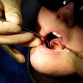 Just over 10,000 children from the most deprived fifth of Scottish households engaged with Scottish dentistry last year, compared to 12,645 for children from the most wealthy.
