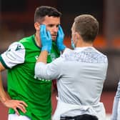 Hibs defender Paul McGinn is assessed by the physio after a clash of heads during a match with Dundee United earlier this season