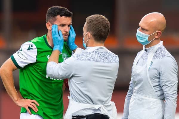 Hibs defender Paul McGinn is assessed by the physio after a clash of heads during a match with Dundee United earlier this season