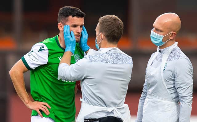 Hibs defender Paul McGinn is assessed by the physio after a clash of heads during a match with Dundee United earlier this season